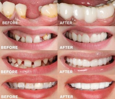 G. K DENTAL CLINIC ORTHODONTIC AND IMPLANT CENTRE NADUVANNUR